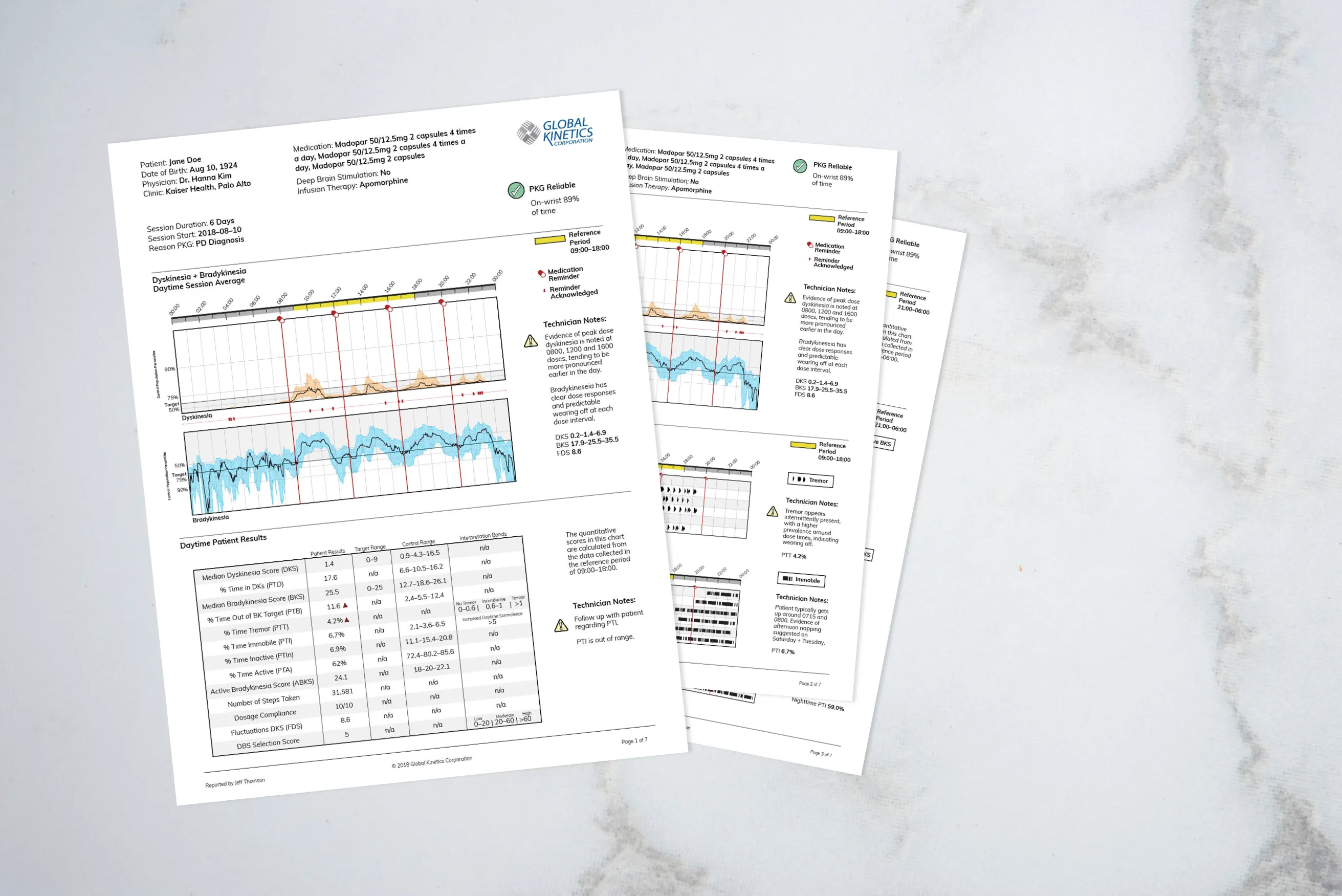 Parkinson’s Disease Report System Redesign